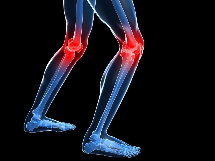 In-Home Rehabilitation Northport NY - Is Knee Surgery in Your Loved One's Future?